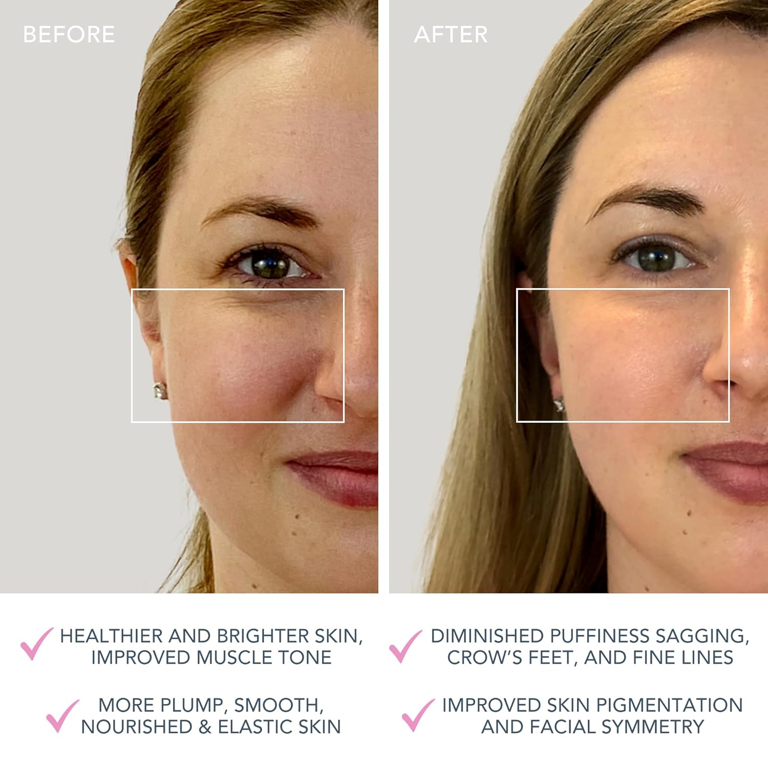 Mini Microcurrent Facial Device - Face Sculpting Tool - Firm & Contour - Reduce Double Chin - Non-Invasive - Increases Absorption of Facial